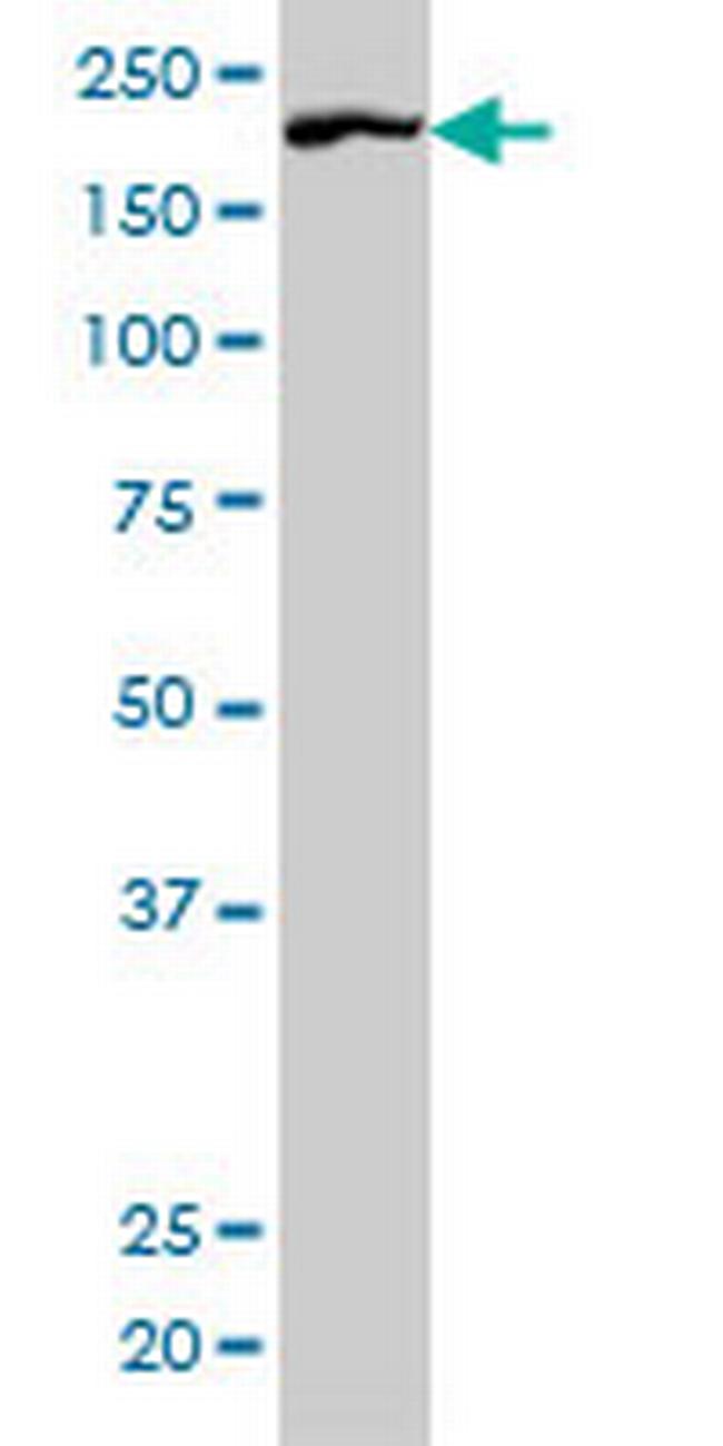 ROCK1 Antibody in Western Blot (WB)