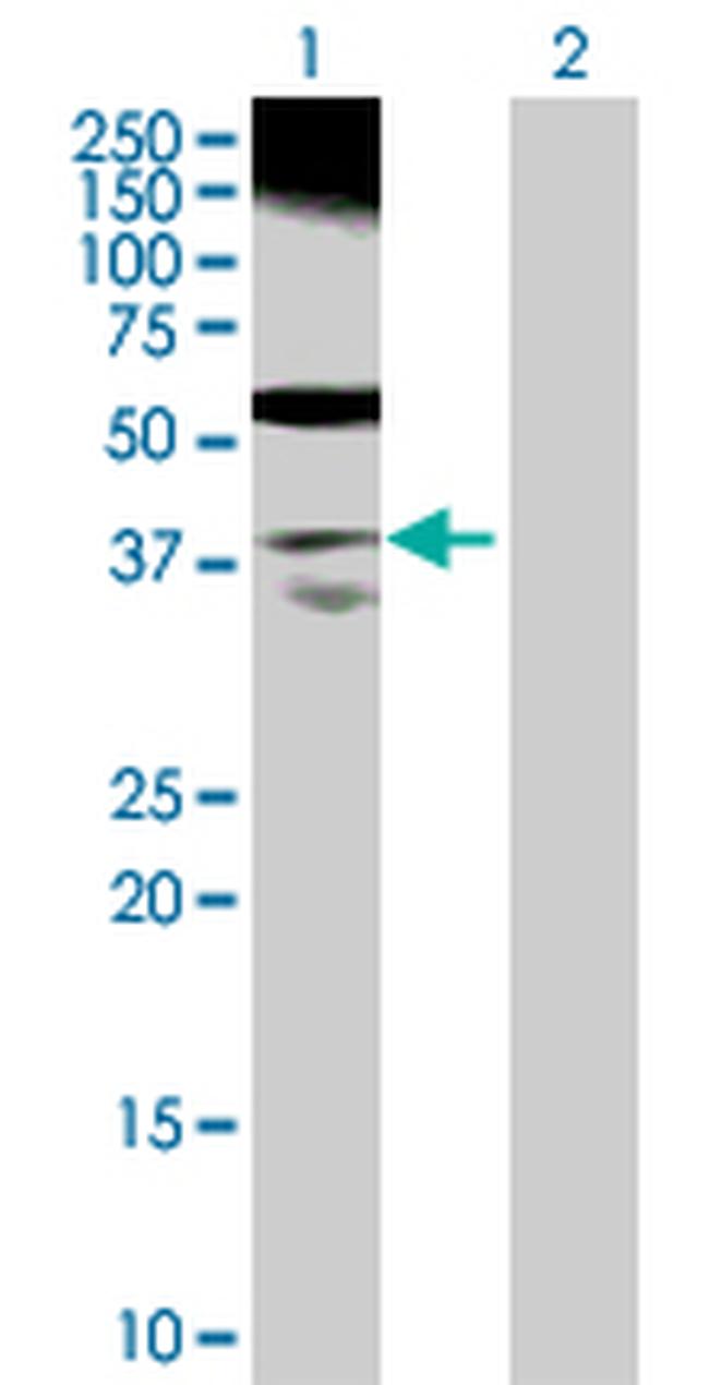 RP2 Antibody in Western Blot (WB)