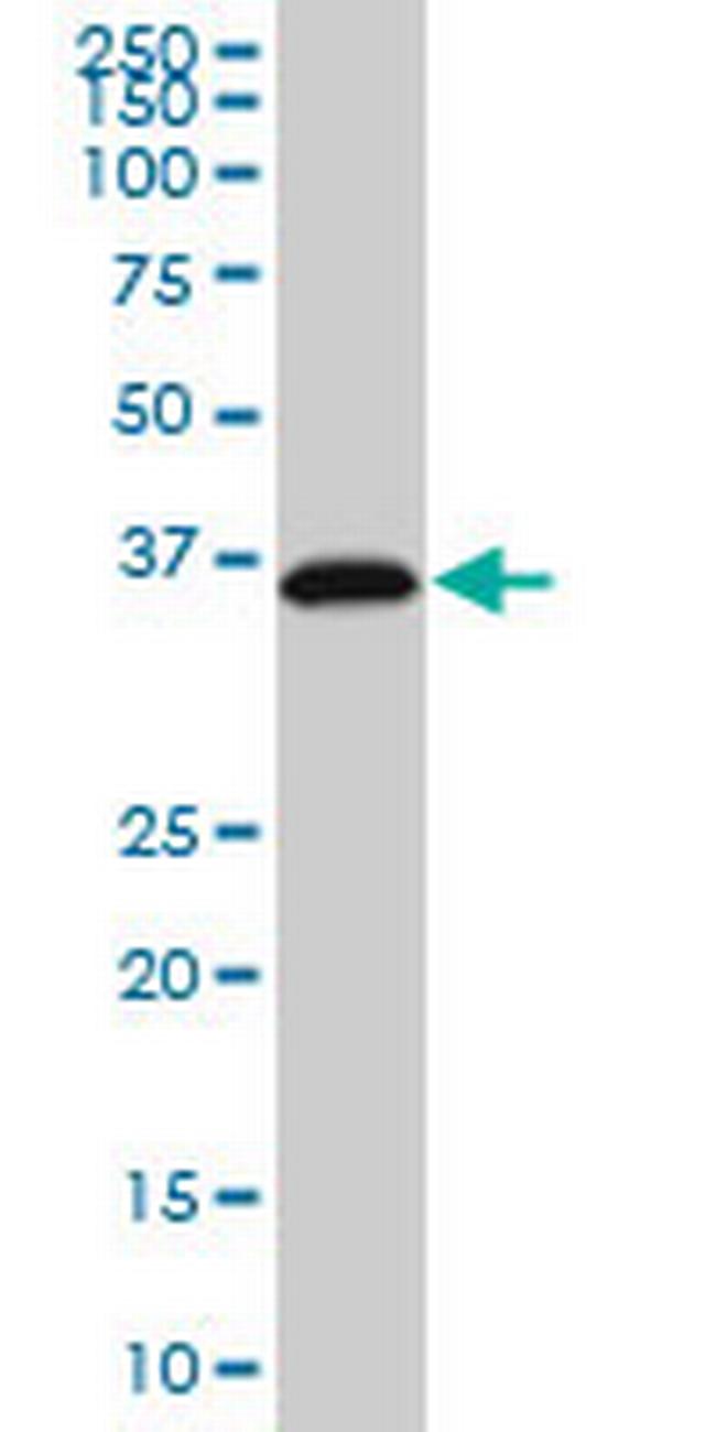 RP2 Antibody in Western Blot (WB)