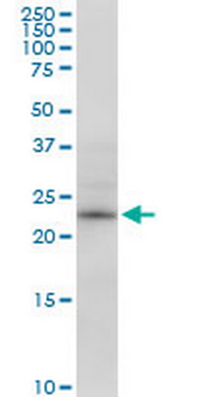 RPE Antibody in Western Blot (WB)