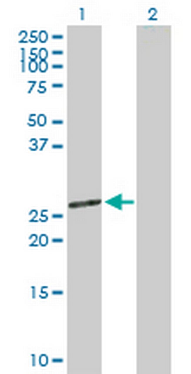 MRPL12 Antibody in Western Blot (WB)