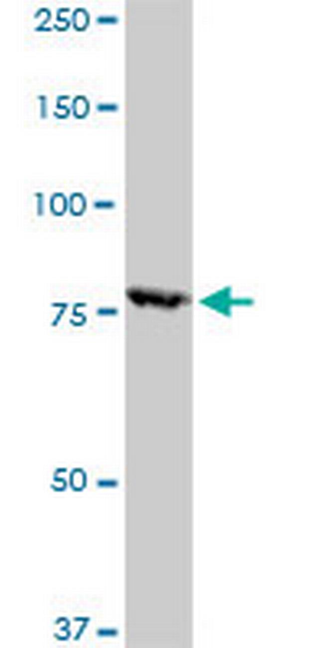 RPS6KA1 Antibody in Western Blot (WB)