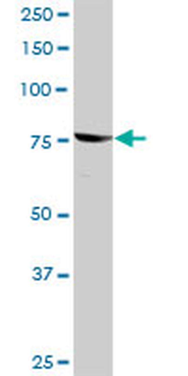 RPS6KA3 Antibody in Western Blot (WB)