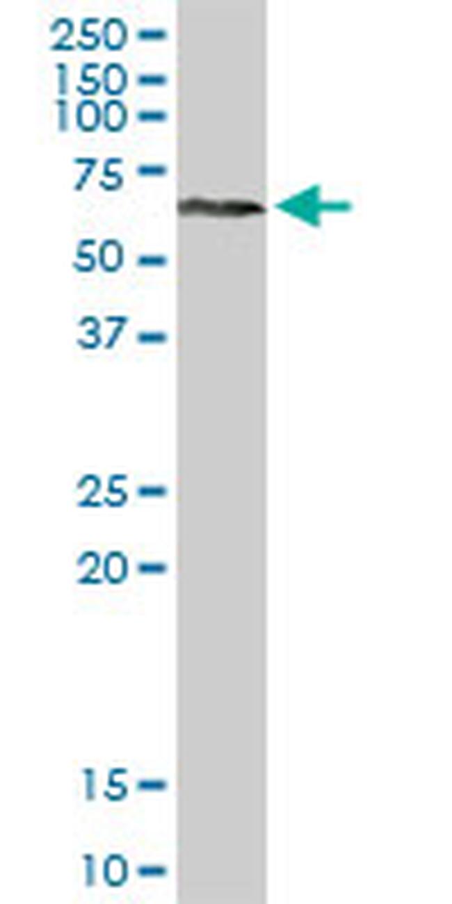 RPS6KA3 Antibody in Western Blot (WB)