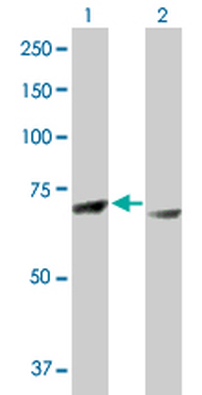 RPS6KA3 Antibody in Western Blot (WB)