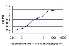 RPS6KB1 Antibody in ELISA (ELISA)