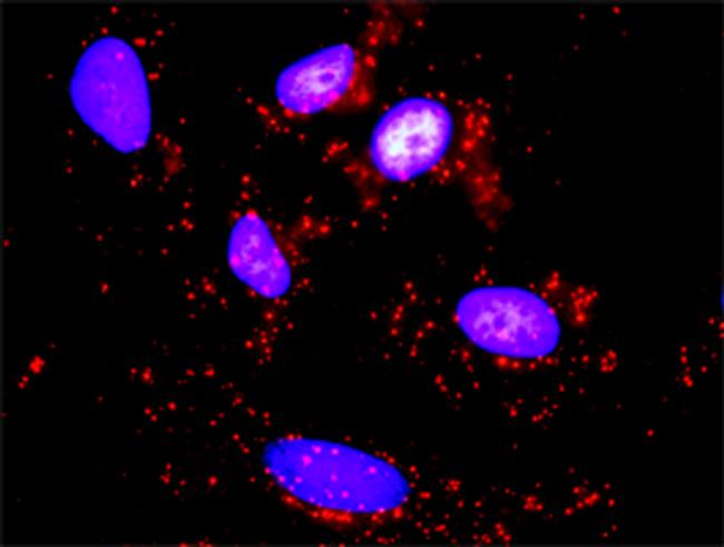 RPS6KB1 Antibody in Proximity Ligation Assay (PLA) (PLA)