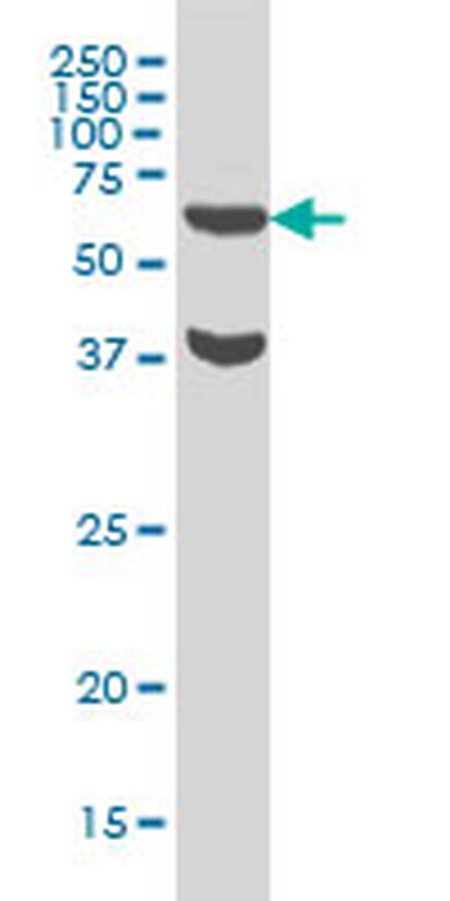 RPS6KB1 Antibody in Western Blot (WB)