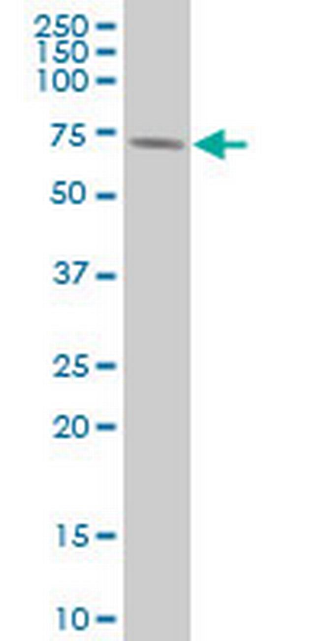 RPS6KB1 Antibody in Western Blot (WB)