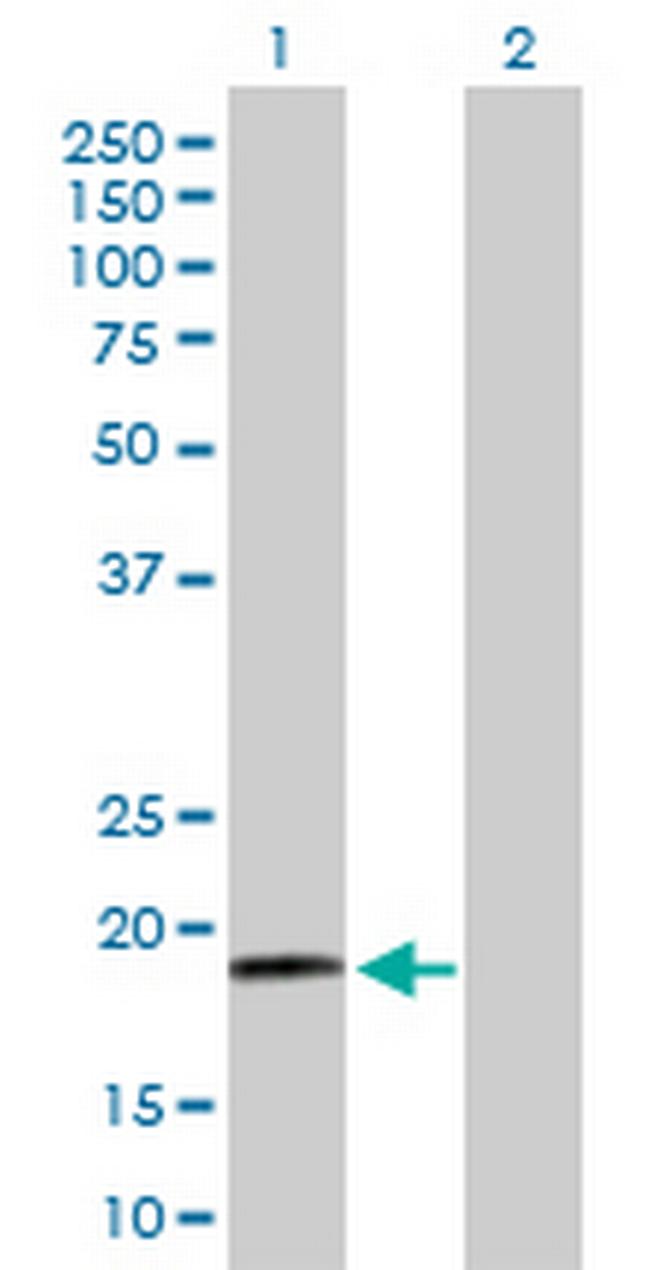 RPS19 Antibody in Western Blot (WB)