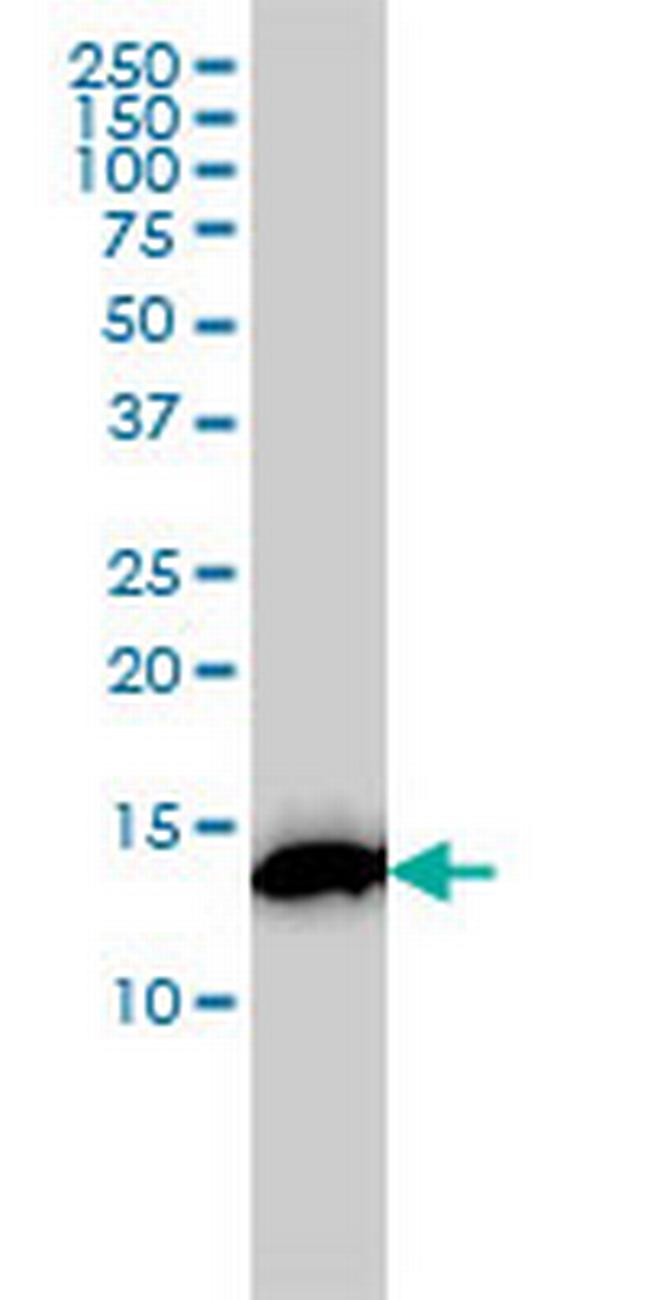 RPS19 Antibody in Western Blot (WB)