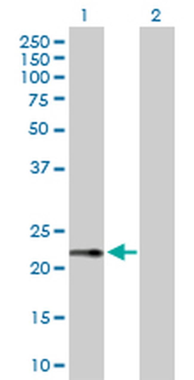 RPS27A Antibody in Western Blot (WB)