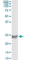 RRAS Antibody in Immunoprecipitation (IP)