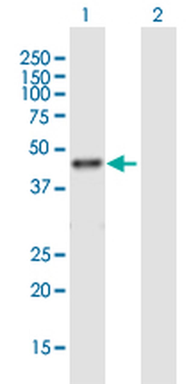 RRM2 Antibody in Western Blot (WB)