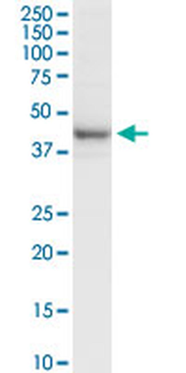 RRM2 Antibody in Western Blot (WB)