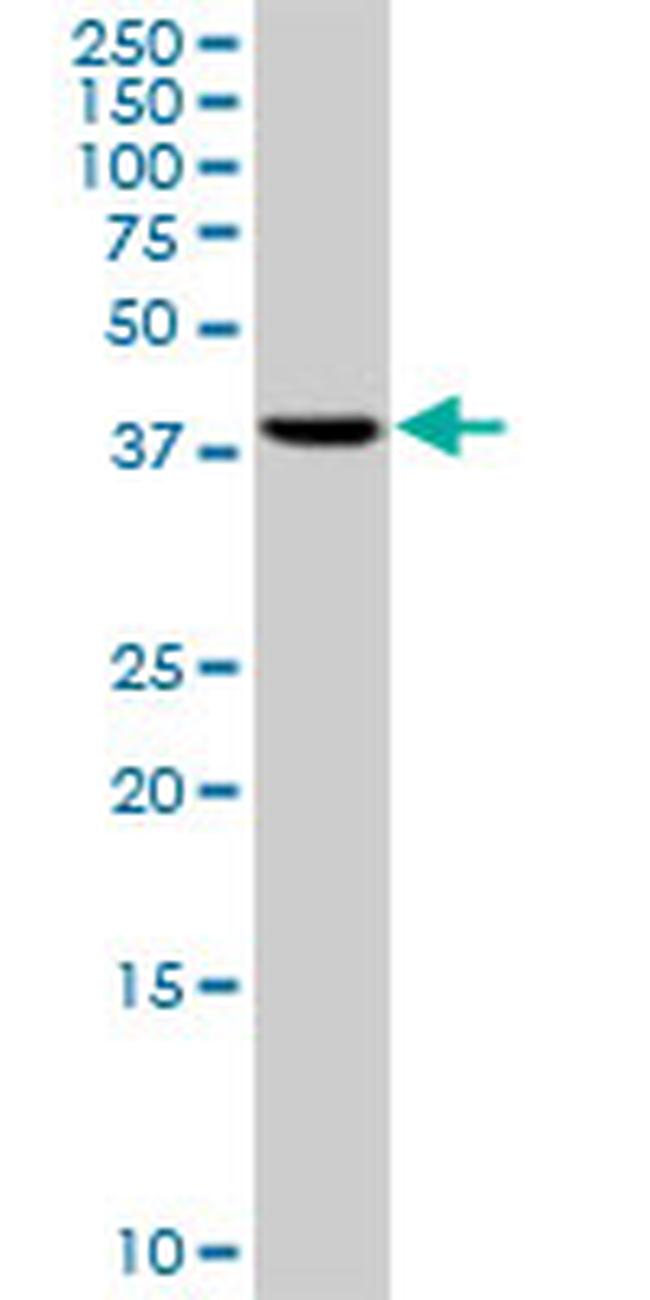 RRM2 Antibody in Western Blot (WB)