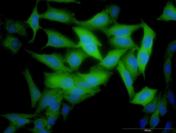 RRM2 Antibody in Immunocytochemistry (ICC/IF)