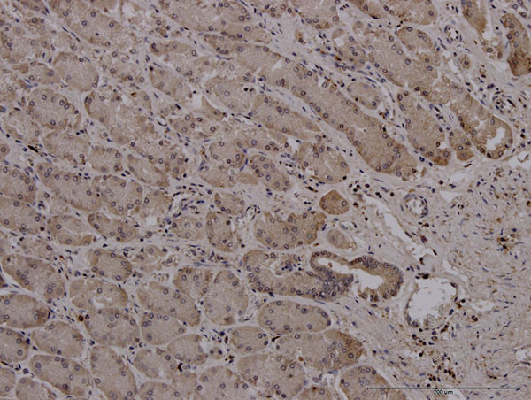 RRM2 Antibody in Immunohistochemistry (Paraffin) (IHC (P))