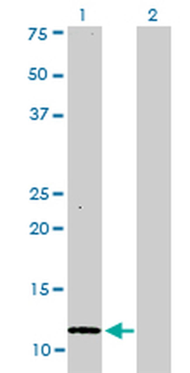 S100A1 Antibody in Western Blot (WB)