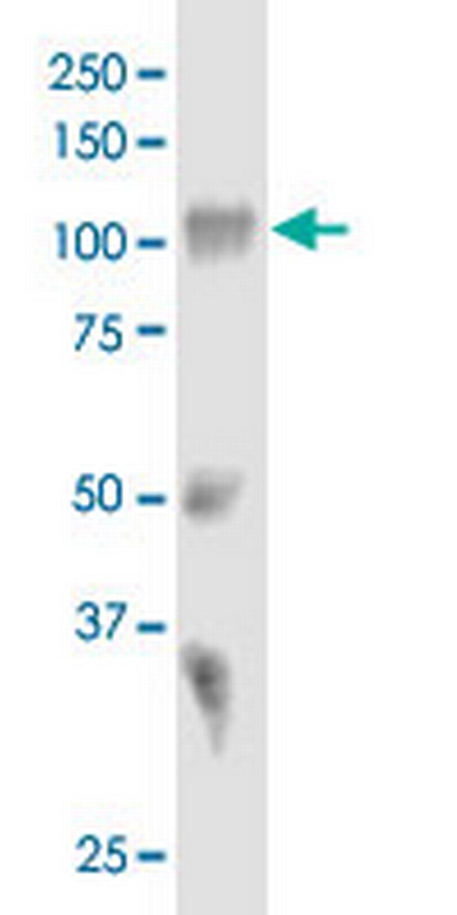 SORT1 Antibody in Western Blot (WB)