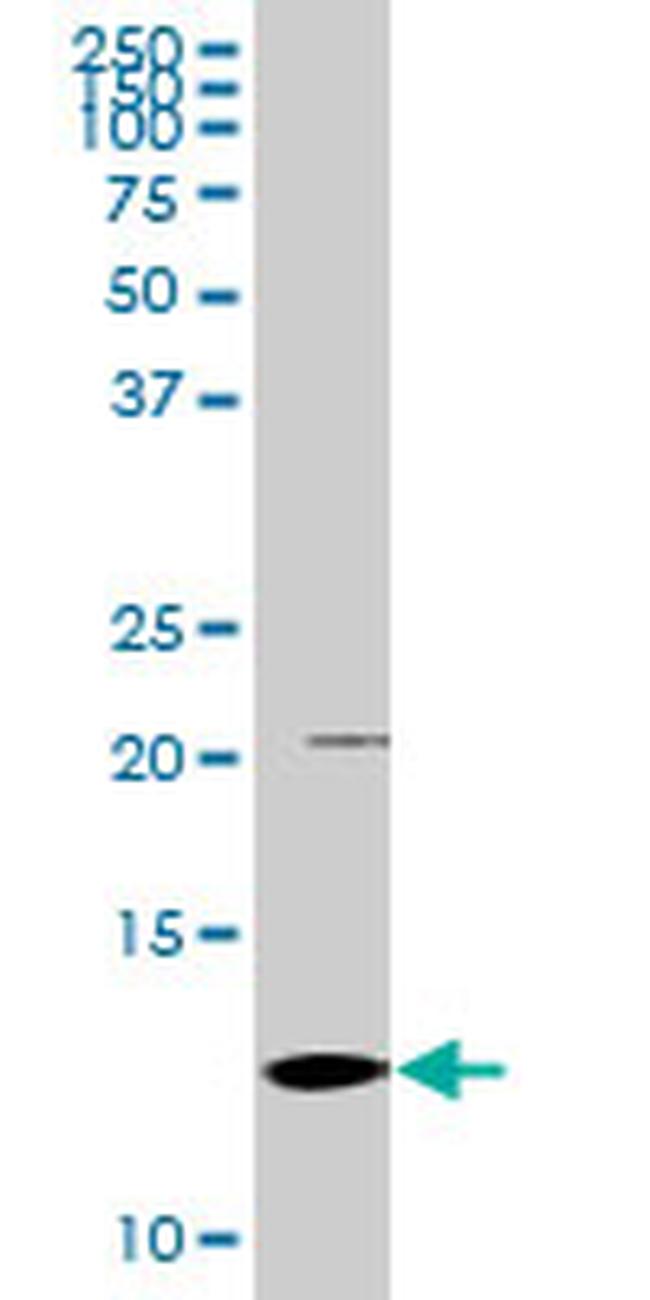 S100A2 Antibody in Western Blot (WB)