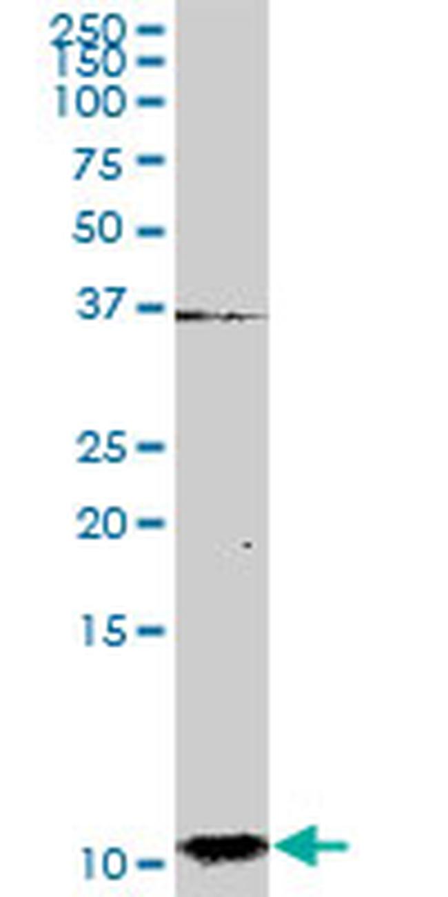 S100A2 Antibody in Western Blot (WB)