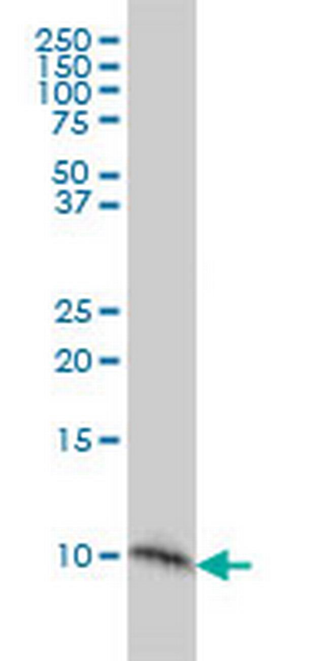 S100A2 Antibody in Western Blot (WB)