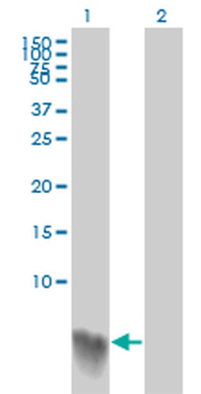 S100A2 Antibody in Western Blot (WB)