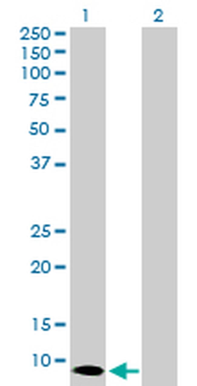 S100A7 Antibody in Western Blot (WB)