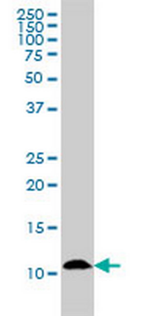 S100A7 Antibody in Western Blot (WB)