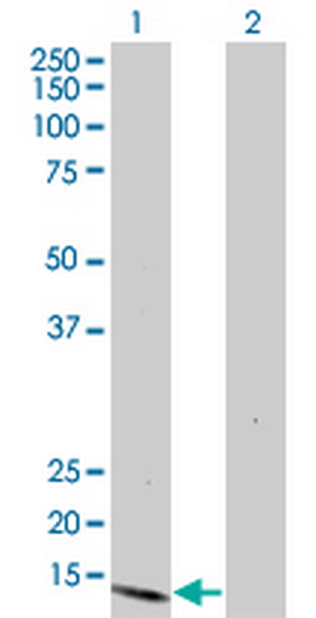 S100A7 Antibody in Western Blot (WB)