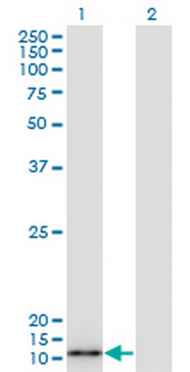 S100A7 Antibody in Western Blot (WB)