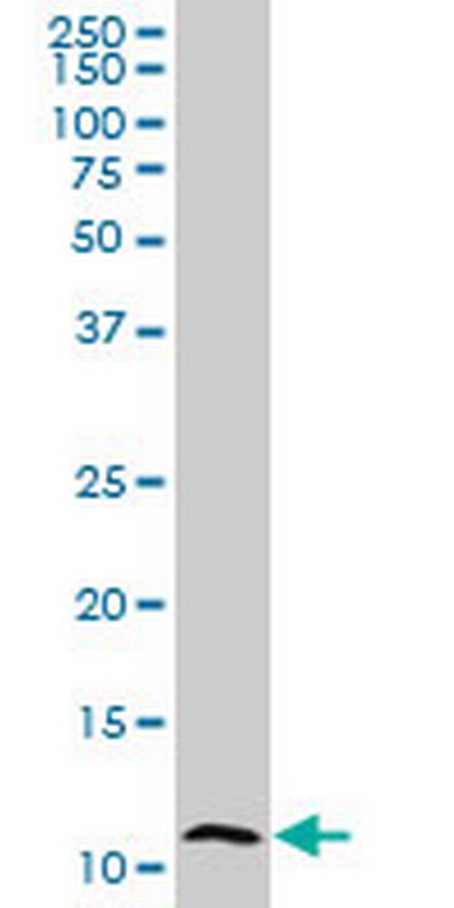 S100A7 Antibody in Western Blot (WB)