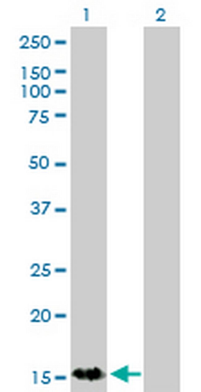 S100A9 Antibody in Western Blot (WB)