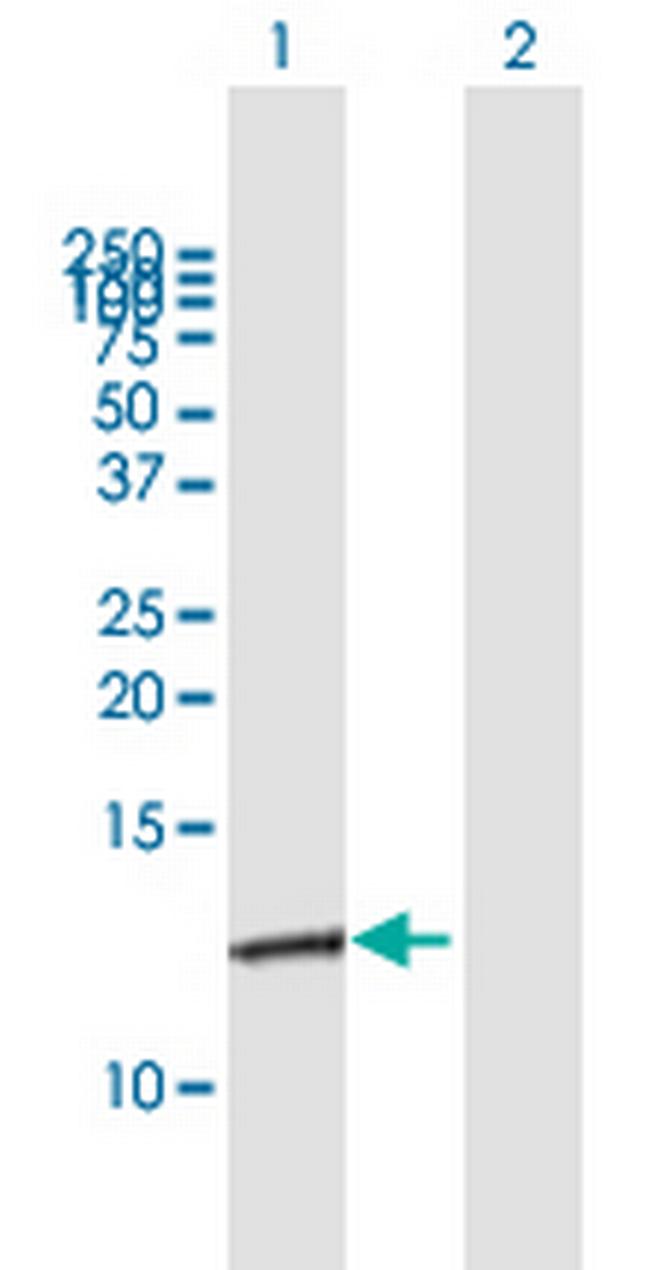 S100A10 Antibody in Western Blot (WB)