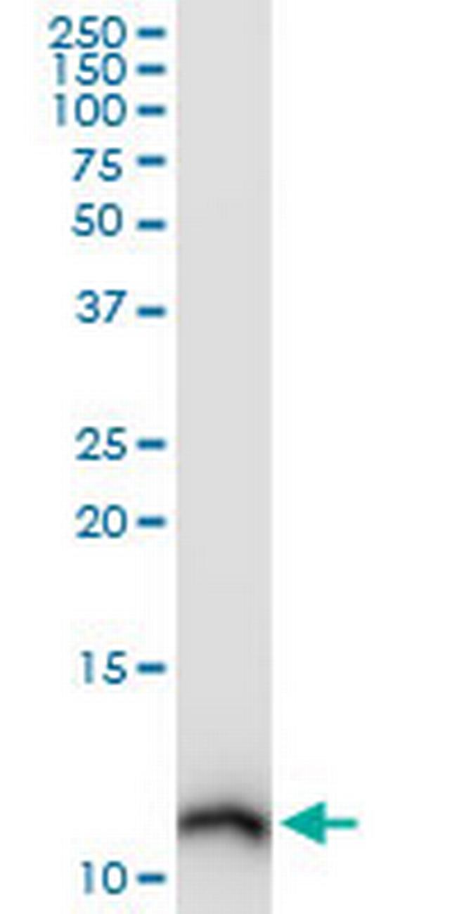 S100A10 Antibody in Western Blot (WB)