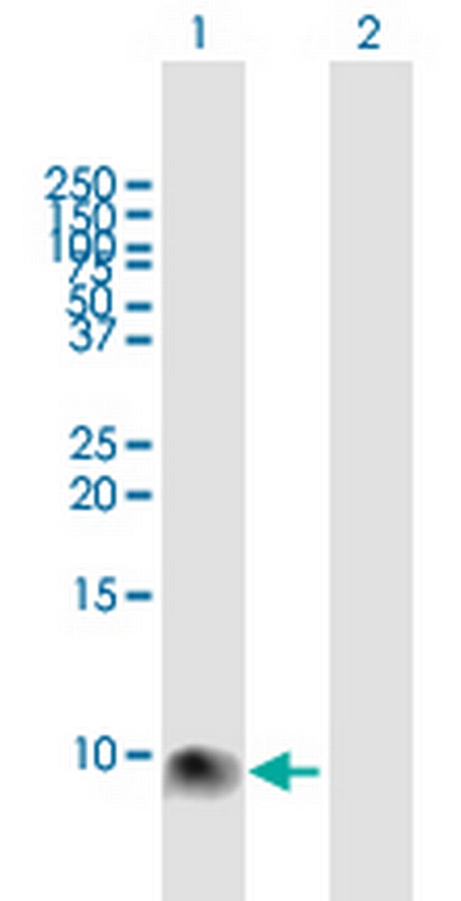 S100A12 Antibody in Western Blot (WB)