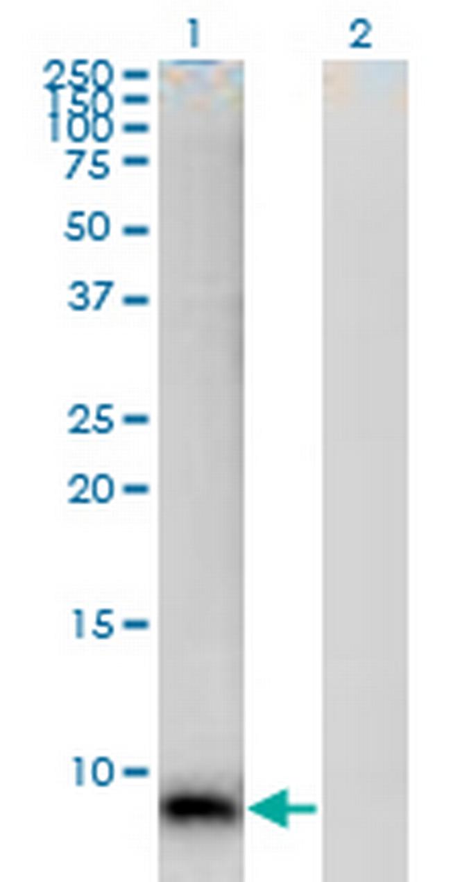 S100A12 Antibody in Western Blot (WB)