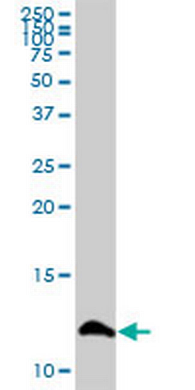 S100A13 Antibody in Western Blot (WB)