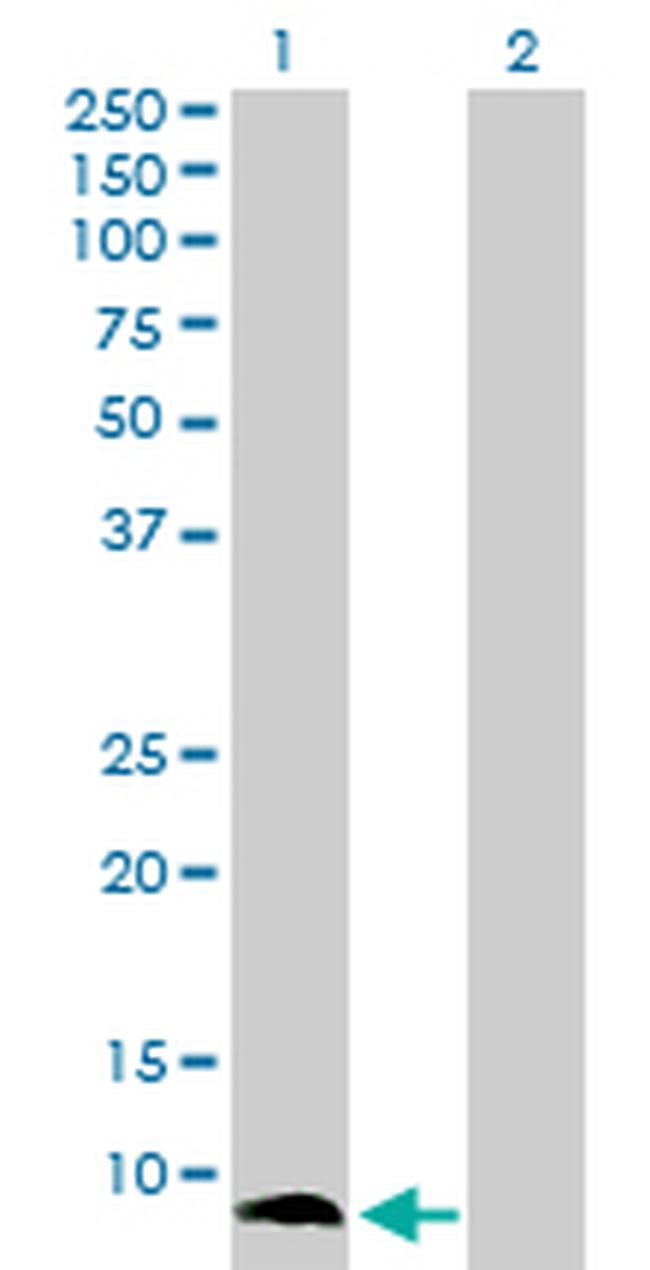 S100A13 Antibody in Western Blot (WB)