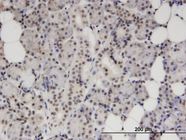 S100B Antibody in Immunohistochemistry (Paraffin) (IHC (P))