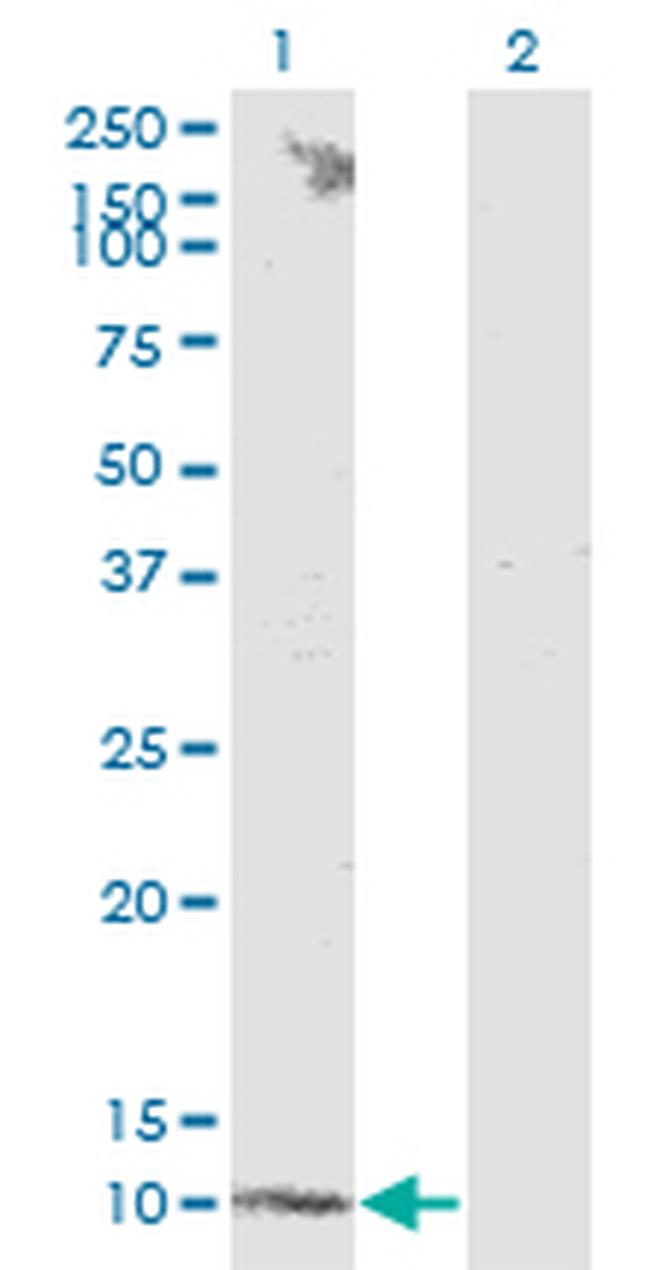 S100B Antibody in Western Blot (WB)