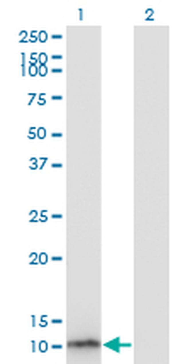 S100B Antibody in Western Blot (WB)