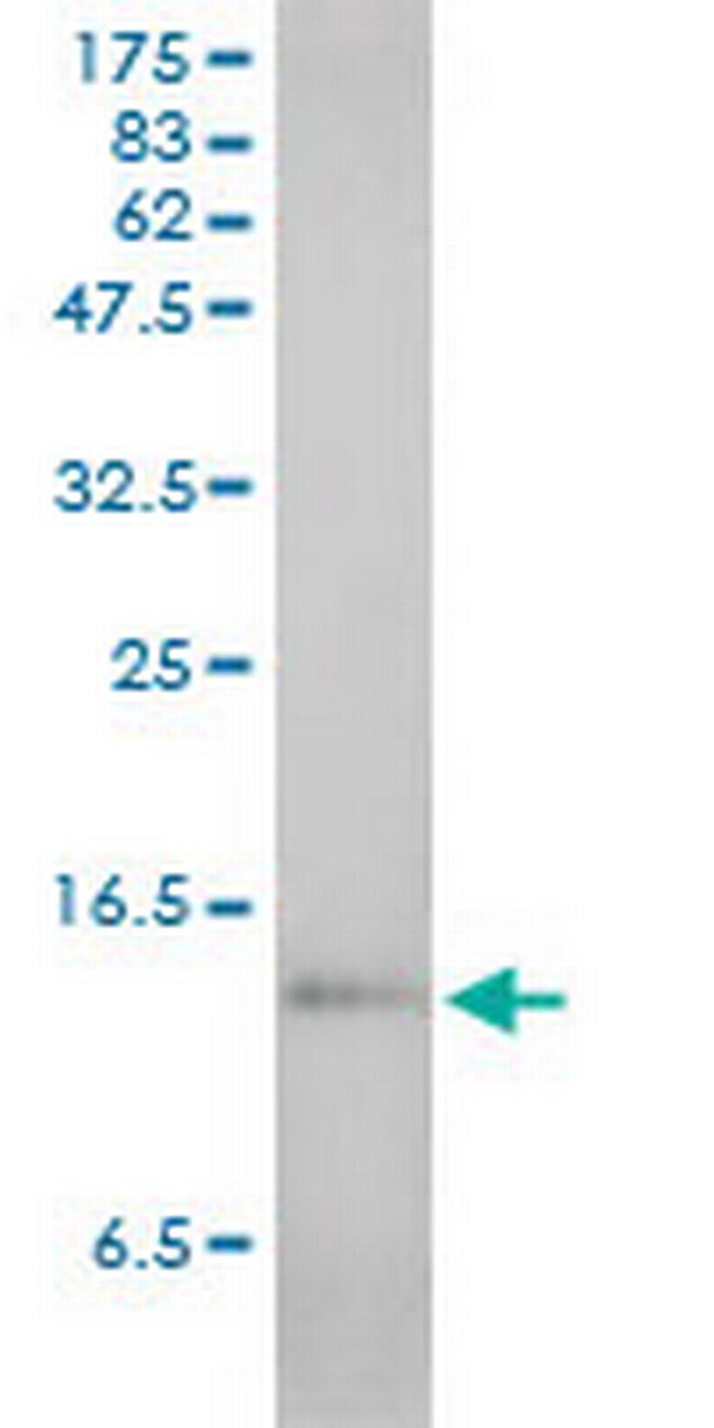 SAA1 Antibody in Western Blot (WB)