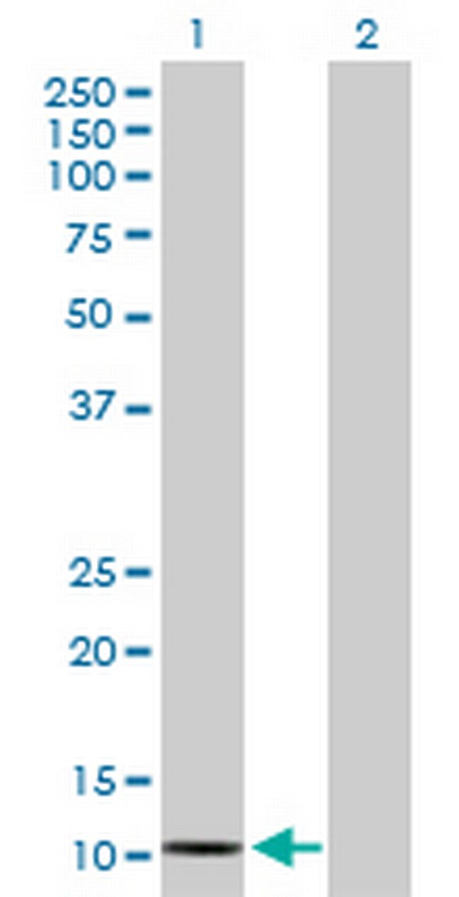 SAA2 Antibody in Western Blot (WB)