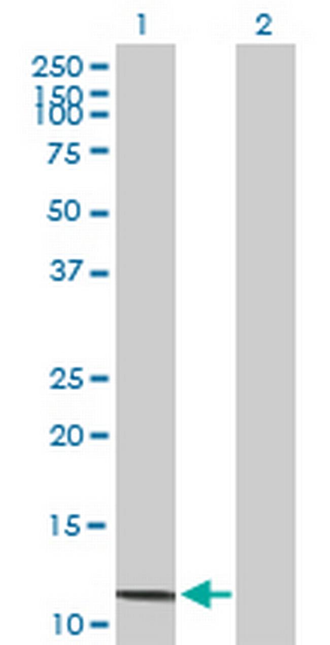 SAA4 Antibody in Western Blot (WB)