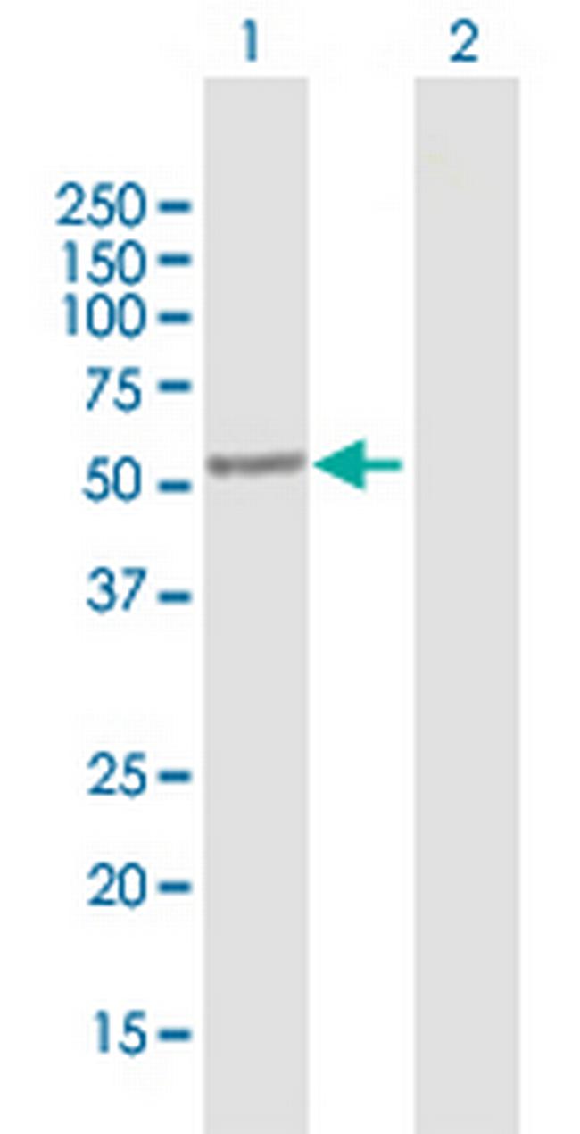 SAG Antibody in Western Blot (WB)