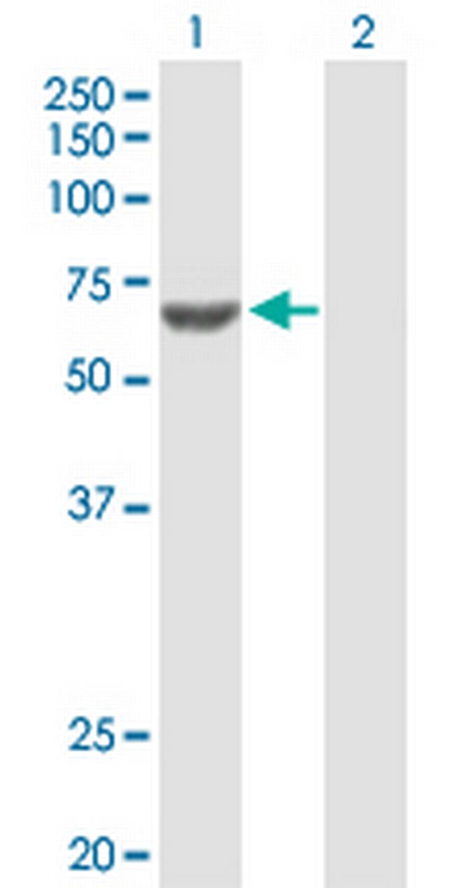 ACSM3 Antibody in Western Blot (WB)