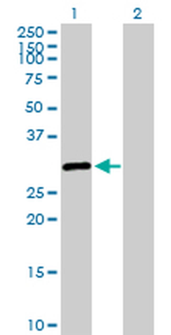 SALL2 Antibody in Western Blot (WB)