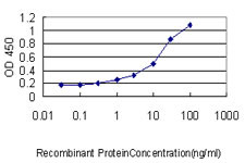 SARS Antibody in ELISA (ELISA)